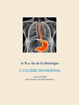 cover image of Le b.a.-ba de la diététique pour l'ulcère duodénal